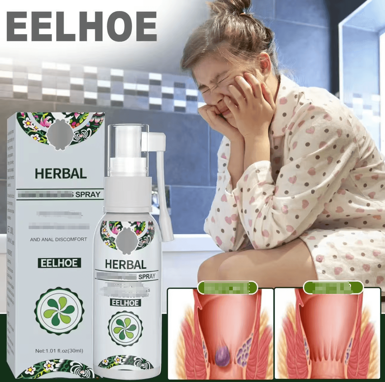Eelhoe Herbal Hemorrhoids Spray 30ml, Treats External Hemorrhoids, Fissures & Discomfort