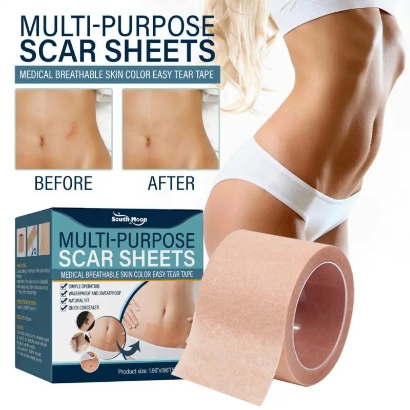 South Moon Silicone Scar Sheets Painless Scar Repair Tape Roll Effective Scar Removal Strips For Keloid Surgery Burn Acne (5cmx500cm)