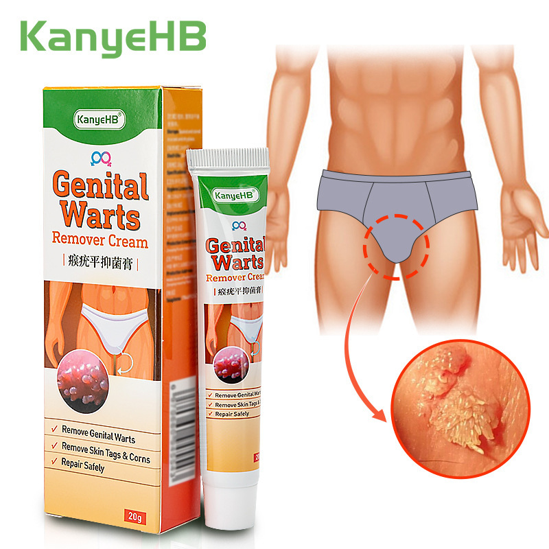 KanyeHB Genital Warts Remover Cream 20g Remover Skin Tags & Corns Repair Safely Suitable for Men and Women
