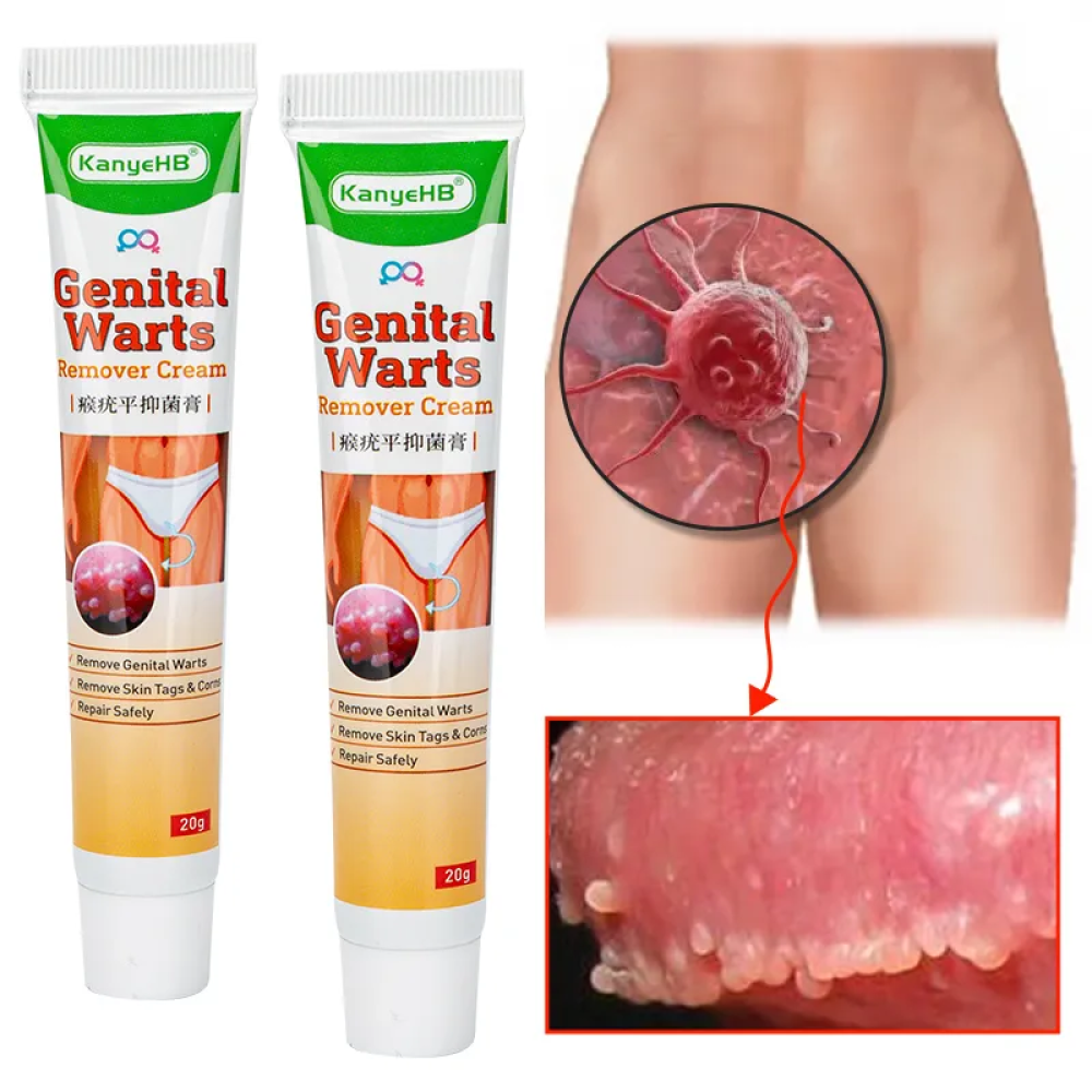 Genital Warts Removal Cream Vulva Anus Genital Herpes Warts Special Ointment Human Papilloma Virus Herbal Ointment