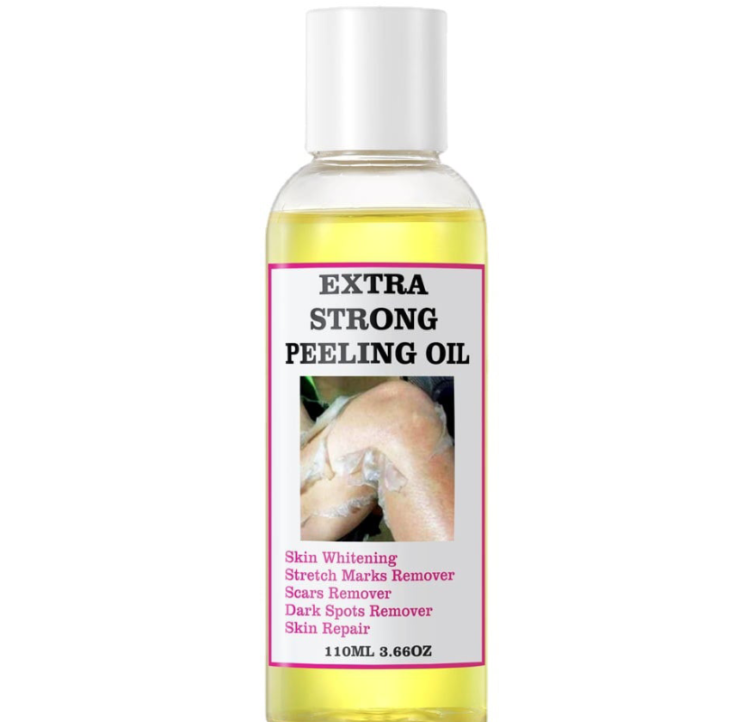 Extra Strong Peeling Oil, Stretch Mark Exfoliating Solution Whitening Oil, Skin Whitening, Stretch Marks Remover, Scar Remover