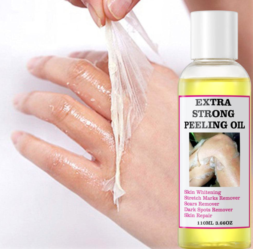 Extra Strong Peeling Oil, Stretch Mark Exfoliating Solution Whitening Oil, Skin Whitening, Stretch Marks Remover, Scar Remover - Image 2
