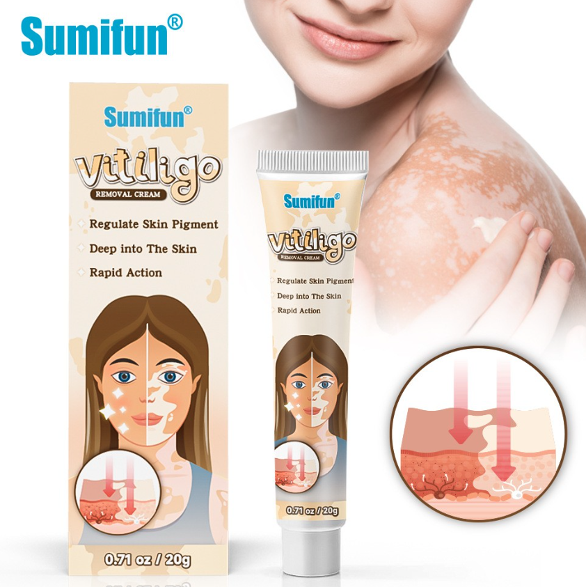 Sumifun Vitiligo Removal Cream 20gm