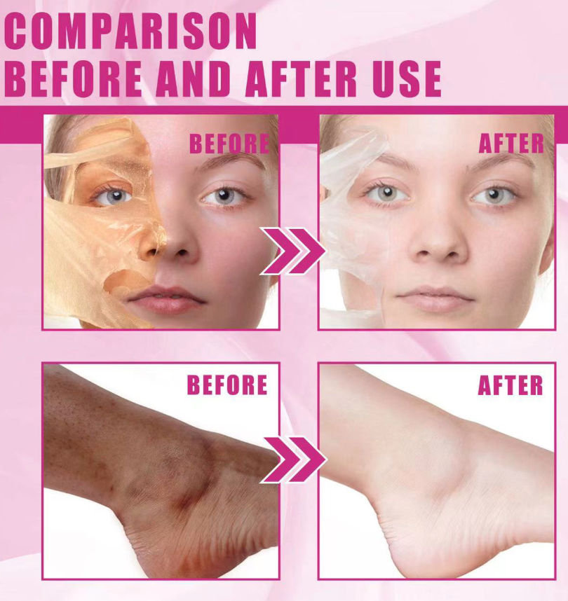 Extra Strong Peeling Oil, Stretch Mark Exfoliating Solution Whitening Oil, Skin Whitening, Stretch Marks Remover, Scar Remover - Image 5