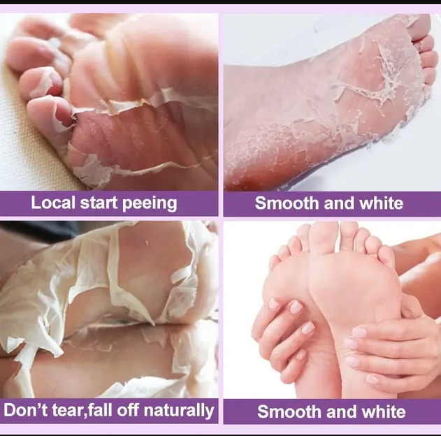 Skailie Exfoliating Foot Mask - Image 2