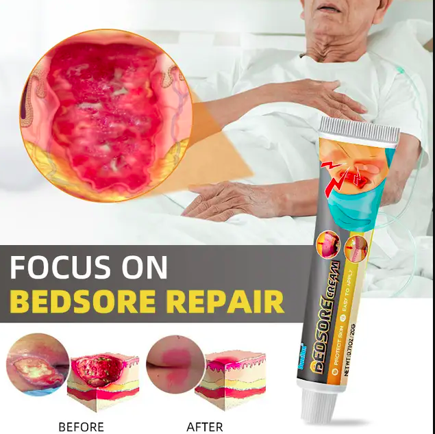 Sumifun Bed sores Treatment Cream Remove Rot Necrotic Tissue Treat Sores Ulcer Wound Healing Ointment Anti-lnfection - Image 4