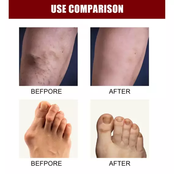 Perfect X Intensive Concentrated Cream - Image 4